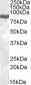 LF / LTF / Lactoferrin Antibody (Internal)